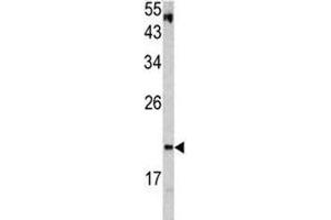 Western blot analysis of VHL antibody and HepG2 lysate. (VHL Antikörper  (AA 181-210))
