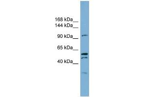 WB Suggested Anti-ANO6 Antibody Titration:  0. (Anoctamin 6 Antikörper  (C-Term))