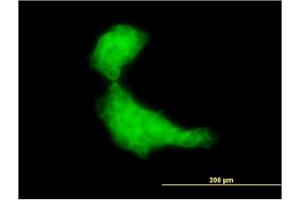 Image no. 3 for anti-DnaJ (Hsp40) Homolog, Subfamily B, Member 2 (DNAJB2) (AA 216-325) antibody (ABIN598751) (DNAJB2 Antikörper  (AA 216-325))