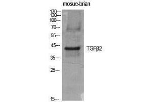 Western Blotting (WB) image for anti-Transforming Growth Factor, beta 2 (TGFB2) (C-Term) antibody (ABIN3187250) (TGFB2 Antikörper  (C-Term))