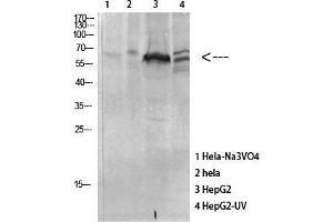 Western Blot (WB) analysis of specific cells using Antibody diluted at 1:1000. (MAPKAP Kinase 5 Antikörper  (pThr182))