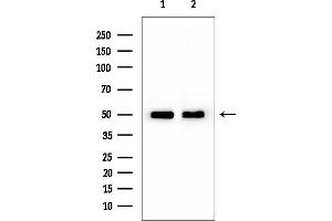 Western blot analysis of lysates from various samples, using CCKAR Mouse Monoclonal Antibody at 1/1000 dilution.