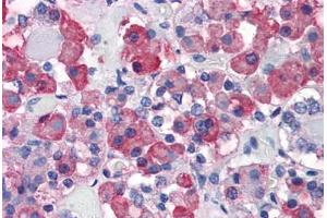 Anterior pituitary: Formalin-Fixed, Paraffin-Embedded (FFPE) (Growth Hormone 1 Antikörper)