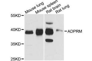 Western blot analysis of extracts of various cell lines, using ADPRM antibody.