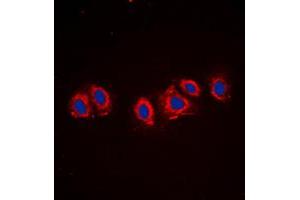 Immunofluorescent analysis of PDGFR alpha staining in NIH3T3 cells. (PDGFRA Antikörper  (C-Term))