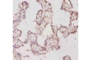 Immunohistochemistry of paraffin-embedded human placenta tissue using ABIN7177935 at dilution of 1:20 (TPT1 Antikörper  (AA 1-172))