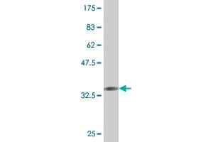 Western Blot detection against Immunogen (36. (ALAS1 Antikörper  (AA 1-98))