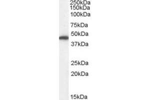 Western Blotting (WB) image for anti-Fumarate Hydratase (FH) (Internal Region) antibody (ABIN2465736) (FH Antikörper  (Internal Region))