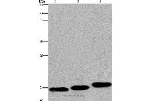 Western blot analysis of Mouse skeletal muscle, heart and bladder tissue, using MYL12B Polyclonal Antibody at dilution of 1:550 (MYL12B Antikörper)