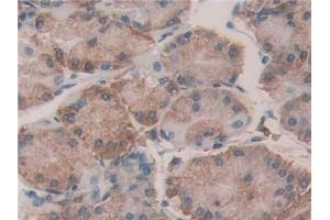 Detection of PDIA4 in Human Stomach Tissue using Polyclonal Antibody to Protein Disulfide Isomerase A4 (PDIA4)