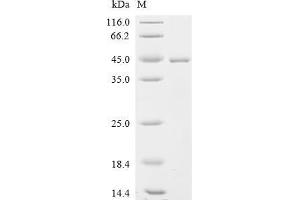 (Tris-Glycine gel) Discontinuous SDS-PAGE (reduced) with 5 % enrichment gel and 15 % separation gel.