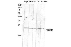 Western Blot (WB) analysis of HepG2 823-AV 293T AD293 HeLa lysis using PGLYRP1 antibody. (PGLYRP1 Antikörper)