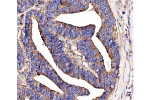 IHC analysis of SCRN1 using anti-SCRN1 antibody (ABIN7602923). (Secernin 1 Antikörper  (C-Term))