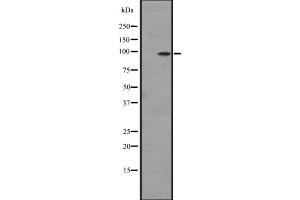Western blot analysis of DDR2 expression in Hela cell lysate,The lane on the left is treated with the antigen-specific peptide. (DDR2 Antikörper  (Internal Region))