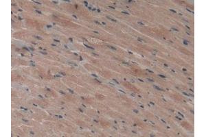 Immunohistochemistry (IHC) image for anti-Vascular Endothelial Growth Factor C (VEGFC) (AA 108-223) antibody (ABIN7429439)