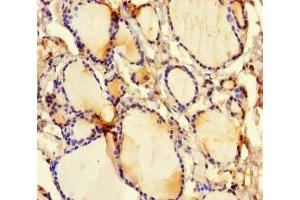 Immunohistochemistry of paraffin-embedded human thyroid tissue using ABIN7153665 at dilution of 1:100 (Non-Syndromic Hearing Impairment Protein 5 (GSDME) (AA 1-496) Antikörper)