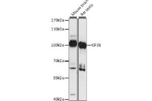 Western blot analysis of extracts of various cell lines, using KIF3B antibody (ABIN7268133) at 1:1000 dilution. (KIF3B Antikörper  (AA 663-747))