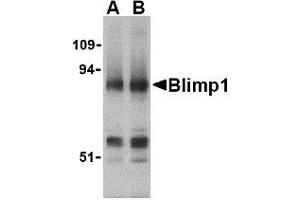 Western blot analysis of Blimp-1 in mouse lung tissue lysate with AP30155PU-N Blimp-1 antibody at (A) 0. (PRDM1 Antikörper  (N-Term))