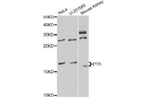 Western blot analysis of extracts of various cell lines, using PTS antibody (ABIN6291724) at 1:1000 dilution. (PTS Antikörper)