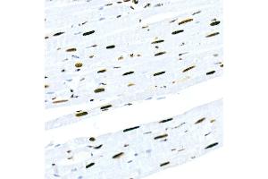 Immunohistochemistry of paraffin-embedded rat heart using HNRNPM Rabbit mAb (ABIN7267635) at dilution of 1:100 (40x lens). (HNRNPM Antikörper)