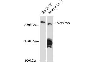 Western blot analysis of extracts of various cell lines, using Versican antibody (ABIN7271309) at 1:1000 dilution. (Versican Antikörper)