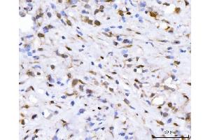 IHC analysis of FGF2 using anti-FGF2 antibody (ABIN7603215). (FGF2 Antikörper  (N-Term))