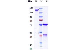 Anti-SOST / Sclerostin Reference Antibody (setrusumab) on SDS-PAGE under reducing (R) condition.