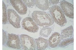 Immunohistochemistry (Formalin/PFA-fixed paraffin-embedded sections) of mouse testis with Slc25a19 polyclonal antibody . (SLC25A19 Antikörper)