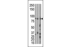 The anti-MARK1 C-term Pab is used in Western blot to detect MARK1 in, from left to right, Hela, T47D, and mouse brain cell line/ tissue lysate. (MARK1 Antikörper  (C-Term))