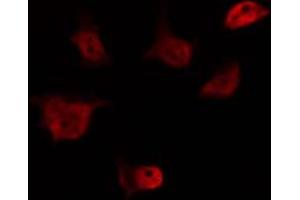 ABIN6274561 staining HeLa by IF/ICC. (EID1 Antikörper  (Internal Region))