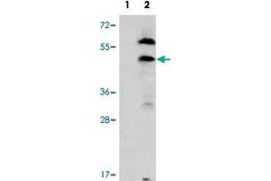 Western blot analysis of PDGFRL (arrow) using PDGFRL polyclonal antibody . (PDGFRL Antikörper  (C-Term))