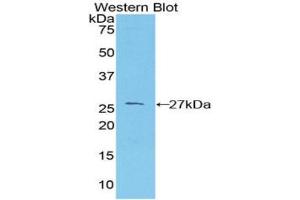 Western blot analysis of the recombinant protein. (PRNP Antikörper  (AA 23-230))