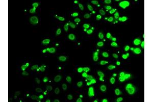 Immunofluorescence analysis of A549 cell using FIP1L1 antibody. (FIP1L1 Antikörper)