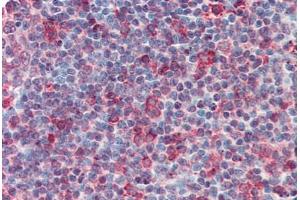 Anti-CD70 antibody  ABIN960750 IHC staining of human tonsil. (CD70 Antikörper  (Internal Region))