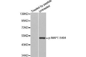 Western Blotting (WB) image for anti-Microtubule-Associated Protein tau (MAPT) (pSer404) antibody (ABIN3019704)