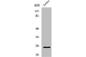 Western Blot analysis of Jurkat cells using Rit1 Polyclonal Antibody (RIT1 Antikörper  (C-Term))