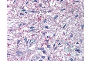 Anti-GPR50 antibody IHC of human pituitary. (GPR50 Antikörper  (C-Term))