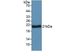 Detection of Recombinant YWHAz, Human using Polyclonal Antibody to Tyrosine 3/Tryptophan 5 Monooxygenase Activation Protein Zeta (YWHAz) (14-3-3 zeta Antikörper  (AA 1-245))