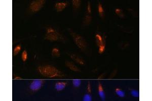 Immunofluorescence analysis of U-2 OS cells using IKK alpha Polyclonal Antibody at dilution of 1:100. (IKK alpha Antikörper)
