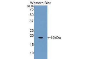 Western Blotting (WB) image for anti-Alpha2 Antiplasmin (SERPINF2) (AA 340-491) antibody (ABIN1172474) (alpha 2 Antiplasmin Antikörper  (AA 340-491))
