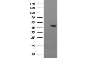 Image no. 2 for anti-butyrobetaine (Gamma), 2-Oxoglutarate Dioxygenase (Gamma-butyrobetaine Hydroxylase) 1 (BBOX1) antibody (ABIN1496820) (BBOX1 Antikörper)