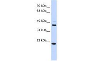 Image no. 1 for anti-Transmembrane Protein 74 (TMEM74) (AA 215-264) antibody (ABIN6741230)