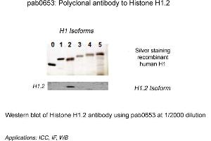 Image no. 1 for anti-Histone Cluster 1, H1c (HIST1H1C) (N-Term) antibody (ABIN410164) (HIST1H1C Antikörper  (N-Term))