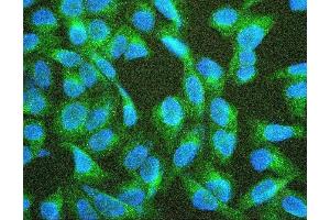 IF analysis of TEK using anti-TEK antibody (ABIN7600762). (TEK Antikörper  (AA 23-616))
