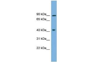 WB Suggested Anti-DYRK1A Antibody Titration: 0. (DYRK1A Antikörper  (N-Term))