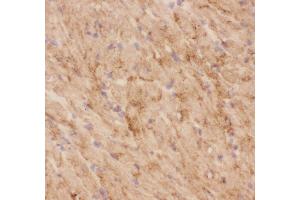 Immunohistochemistry (IHC) image for anti-Solute Carrier Family 2 (Facilitated Glucose Transporter), Member 4 (SLC2A4) (AA 333-509) antibody (ABIN3043929)