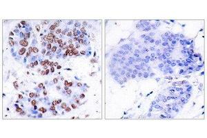Immunohistochemistry (IHC) image for anti-Nuclear Factor-kB p65 (NFkBP65) (Ser276) antibody (ABIN1848140)