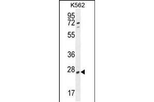 Western blot analysis in K562 cell line lysates (35ug/lane). (hCG_2024410 (AA 187-215), (C-Term) Antikörper)
