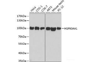 Western blot analysis of extracts of various cell lines using HSP90AA1 Polyclonal Antibody at dilution of 1:500. (HSP90AA1 Antikörper)