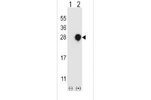 Western blot analysis of RGS4 using rabbit polyclonal RGS4 Antibody using 293 cell lysates (2 ug/lane) either nontransfected (Lane 1) or transiently transfected (Lane 2) with the RGS4 gene. (RGS4 Antikörper  (AA 147-174))